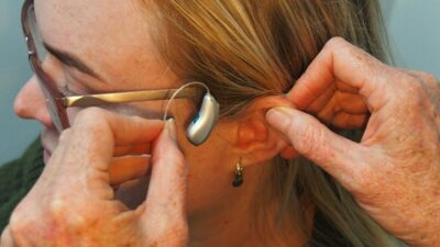 Does Medicaid Cover Hearing Aids