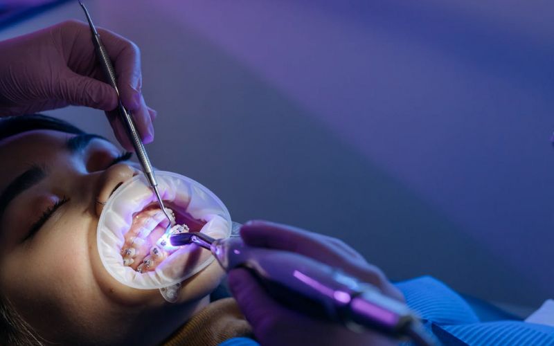 how-can-i-get-braces-if-i-cant-afford-them