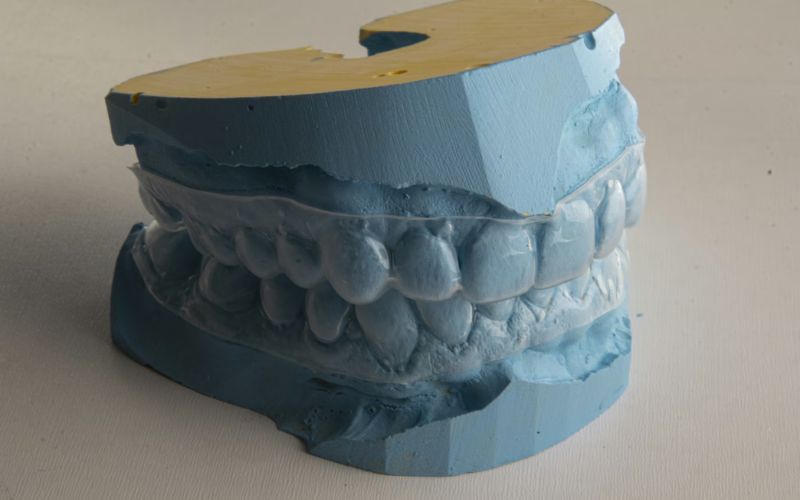 how-do-you-get-invisalign-when-you-cant-afford-it