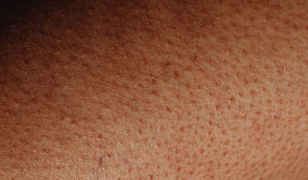 How to Get Rid of Textured Skin