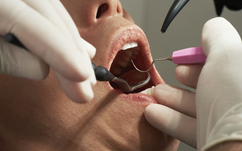 Preventive dental services covered for adults (Image by Unsplash)