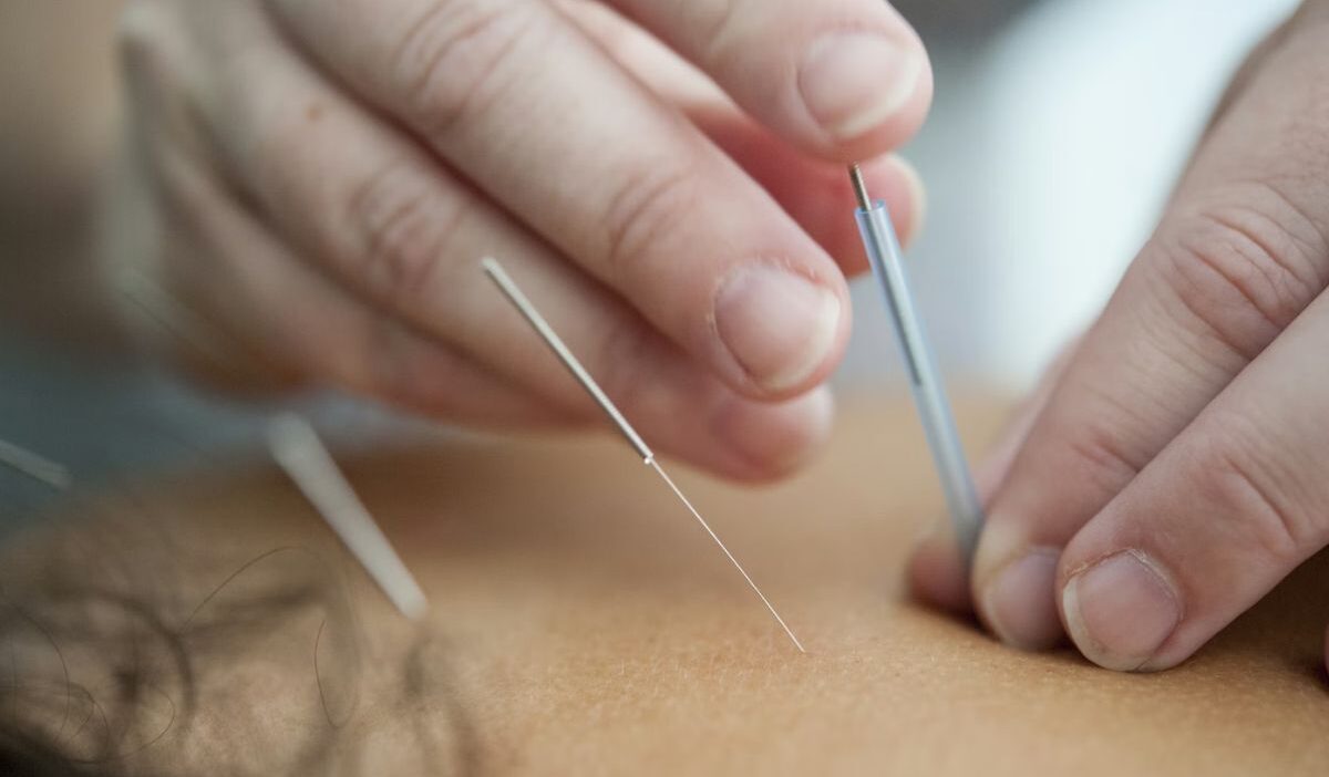 does medicaid cover acupuncture