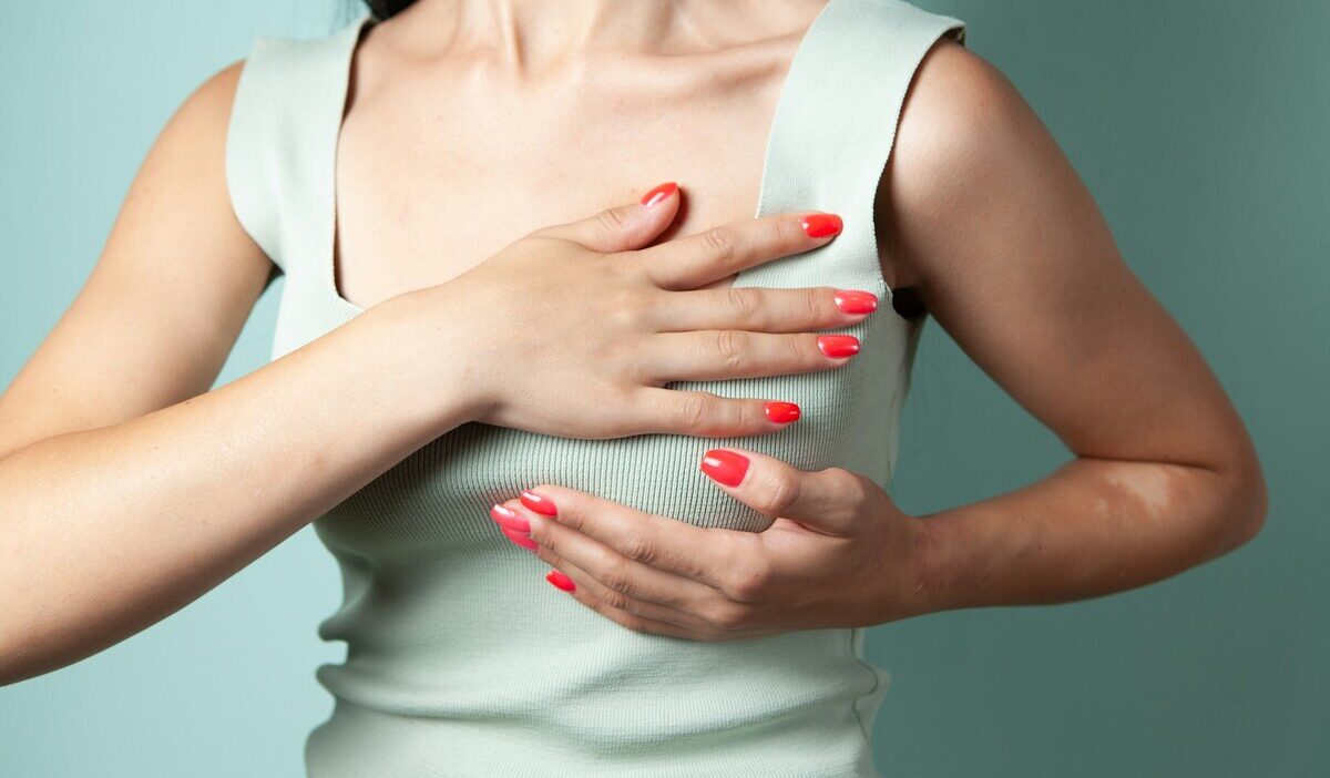 does medicaid cover breast reduction