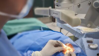 does medicaid cover cataract surgery