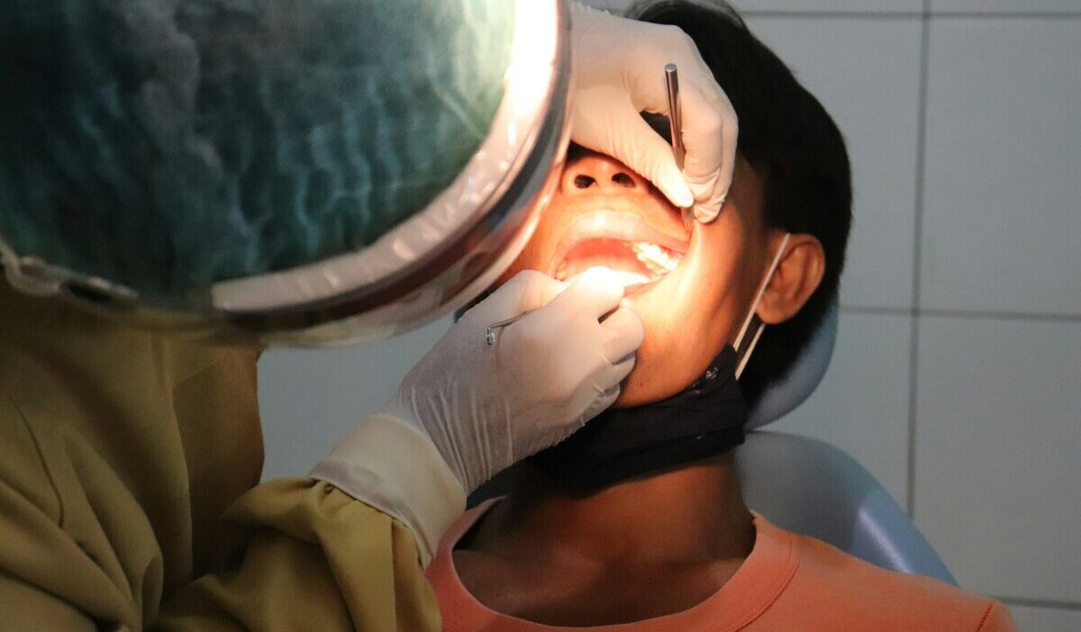 does medicaid cover wisdom teeth removal