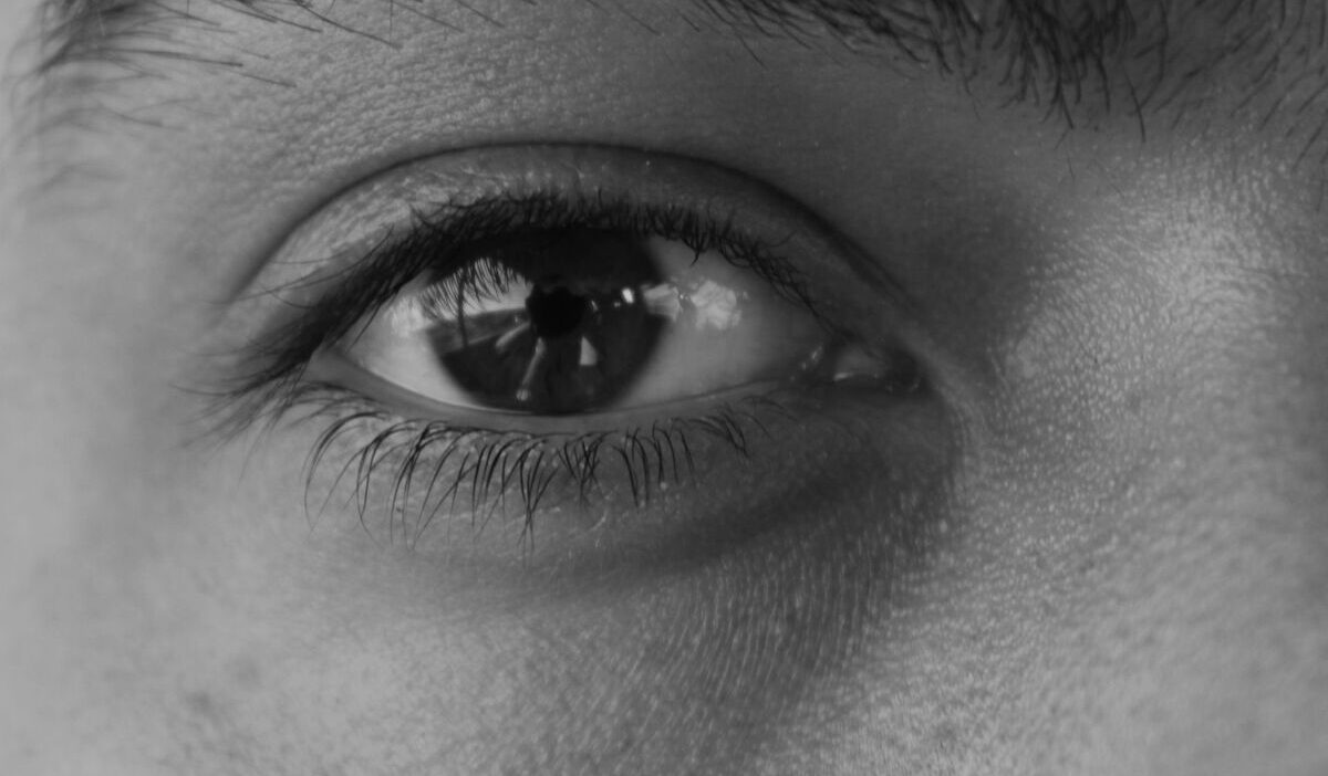 bumps under the eyes cholesterol